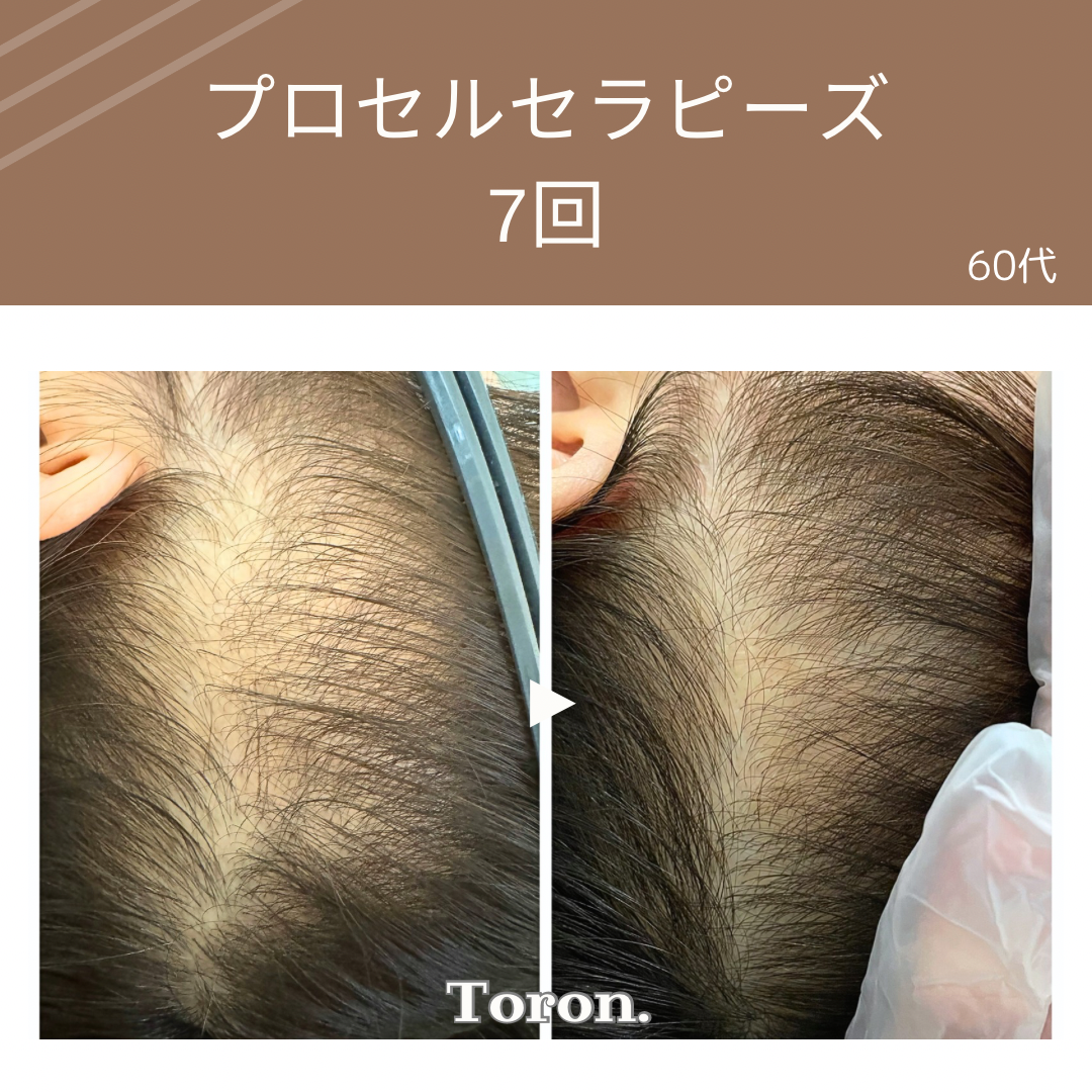 procell theraples プロセルセラピーズ | Toron.